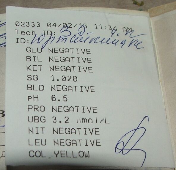 A miña análise de urina leva a femixal